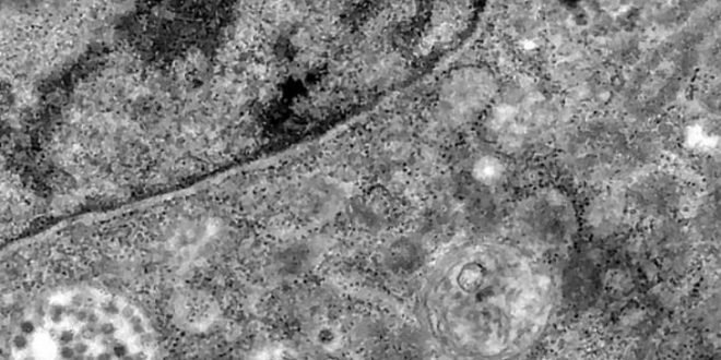 पहली-बार-वायरस-के-स्वस्थ-कोशिकाओं-को-संक्रमित-करने-की-तस्वीरें-आईं,-माइक्रोस्कोप-से-20-लाख-गुना-बड़ी-फोटो-दिखी